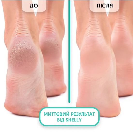 Пенный экспресс-размягчитель для педикюра Shelly Мягкое лезвие 150 мл2
