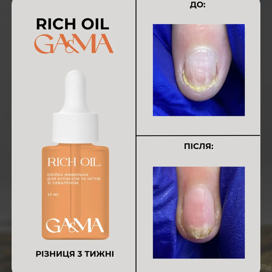Масло питательное GaMa Rich Oil со скваленом 10 мл, Объем: 10 мл
4