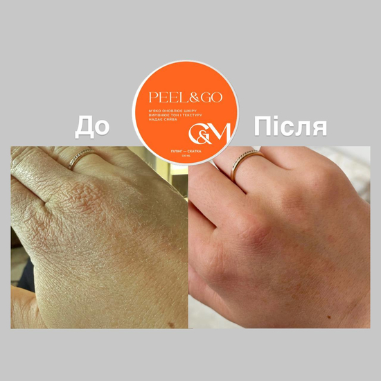Пилинг-скатка GA&MA + Peeling Peel&Go 50 мл2